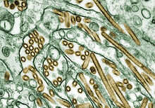 220px-Colorized_transmission_electron_micrograph_of_Avian_influenza_A_H5N1_viruses